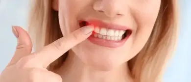 Periodontal Gum Disease Treatment